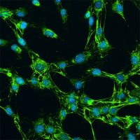 Human Synoviocytes - Innoprot Skeletal Cell System