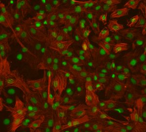 Rat Aortic Smooth Muscle Cells
