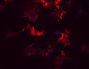 Rat Cardiac Fibroblasts