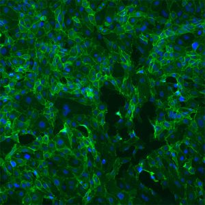 Human Aortic Endothelial Cells