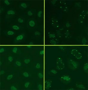 FUS/TLS Stress Granules Assay Cell Line