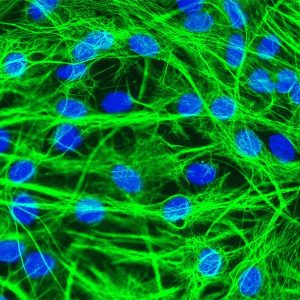 Mouse Astrocytes