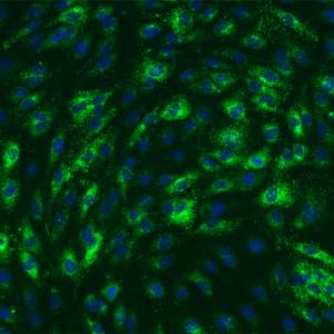 Mouse Hepatic Sinusoidal Endothelial Cells