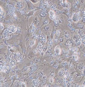 Mouse Hepatic Stellate Cells