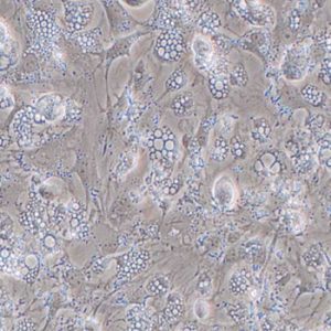 Mouse Hepatic Stellate Cells