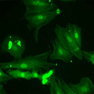 Monkey Lung Microvascular Endothelial Cells