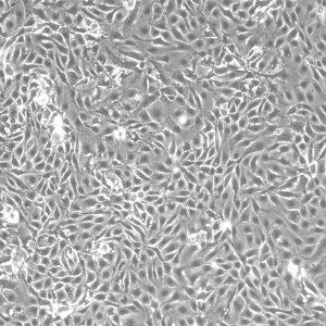 Mouse Renal Proximal Tubular Epithelial Cells