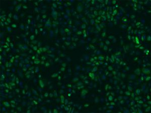 Porcine Corneal Epithelial Cells