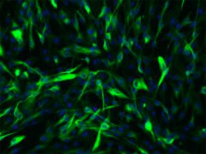 Porcine Retinal Pigment Epithelial Cells
