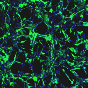 Rat Astrocytes