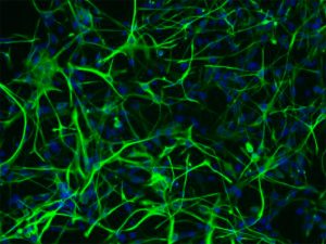 Rat Hippocampal Astrocytes