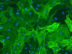 Rat Hepatic Stellate Cells