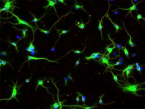 Rat Cortical Neurons