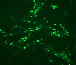 Green Fluorescent beta-2 adrenoreceptor