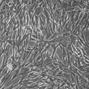Human Adrenal Cortical Cells