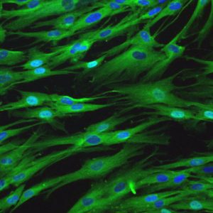 Human Aortic Smooth Muscle Cells