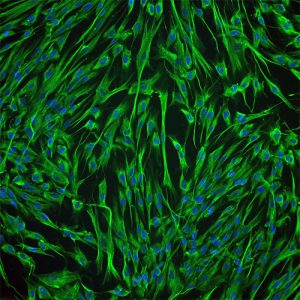 Human Myometrial Smooth Muscle Cells
