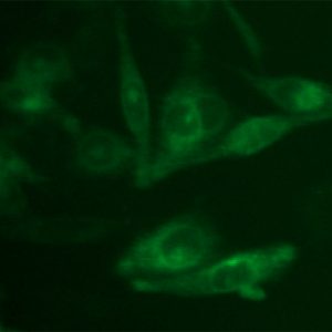 Green Fluorescent B1 Bradykinin Receptor Cell Line