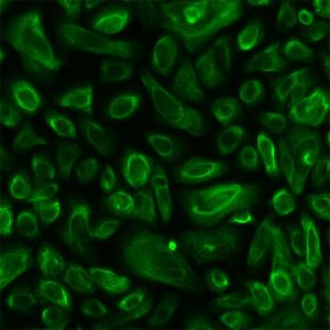 Human Thymic Epithelial Cells
