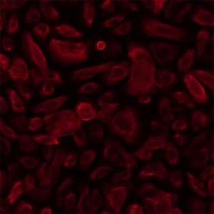 Human Cervical Epithelial Cells