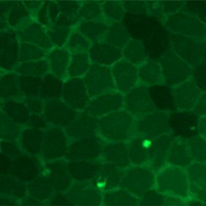 Fluorescent CXCR2 Chemokine Receptor