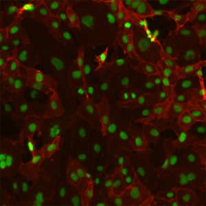Human Endometrial Microvascular Endothelial Cells