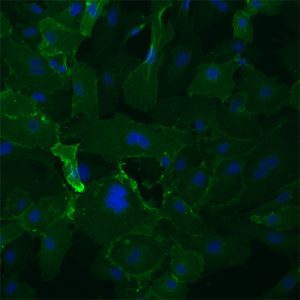 Human Dermal Microvascular Endothelial Cells