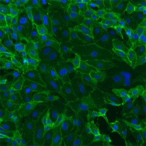 Human Myometrial Microvascular Endothelial Cells