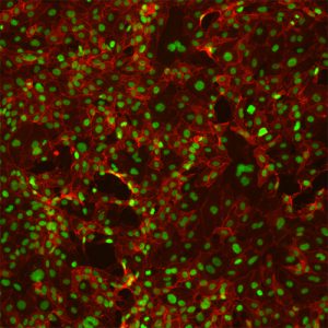 Human Adrenal Microvascular Endothelial Cells