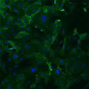 Human Coronary Artery Endothelial Cells