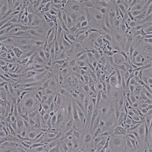 Human Adipose Microvascular Endothelial Cells