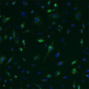 Human Cervical Microvascular Endothelial Cells