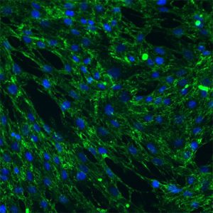 Human Atrial Cardiac Fibroblasts