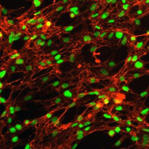 Human Thymic Fibroblasts