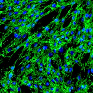Human Pericardial Fibroblasts