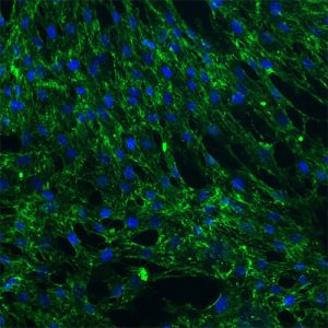 Human Ventricular Cardiac Fibroblasts