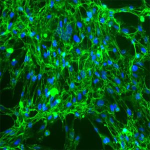 Human Aortic Fibroblasts