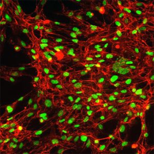 Human Adrenal Fibroblasts