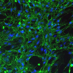 Human Uterine Fibroblasts