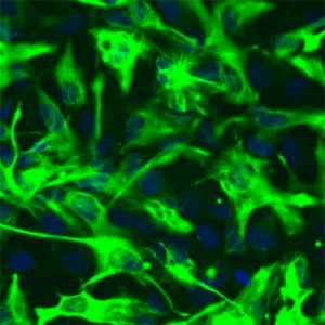 Human Mesencephalic Astrocytes