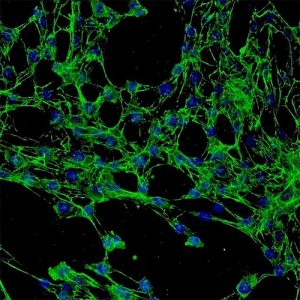 Human Conjunctival Fibroblasts