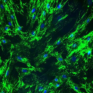 Human Dermal Fibroblasts