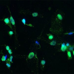 Human Kupffer Cells