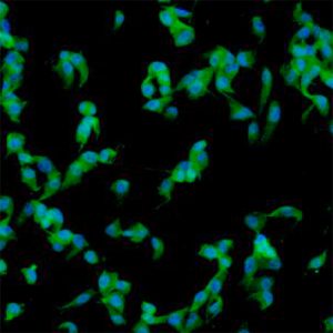 Human Liver Mesenchymal Stem Cells