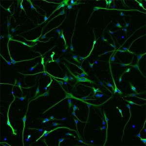 Human Neurons