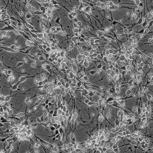 Human Mesencephalic Neurons