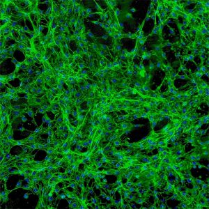 Human Pulmonary Fibroblasts