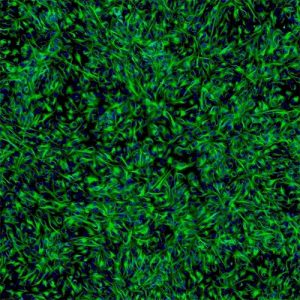 Human Retinal Pigment Epithelial Cells