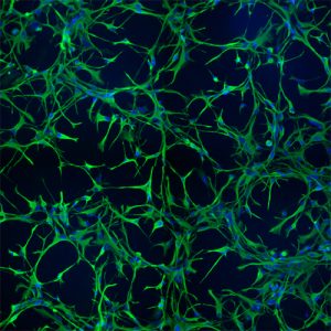 Human Astrocytes