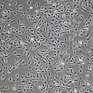 Immortalized Human Conjunctival Epithelial Cell Line